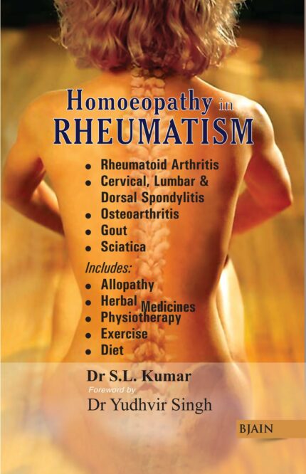 HOMOEOPATHY IN RHEUMATISM